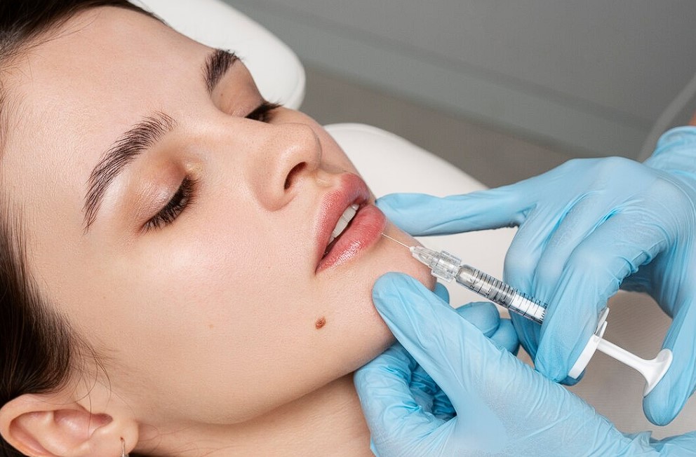 Tratamiento para los Labios, Con Acido Hialurónico.